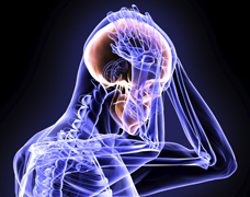 What is a Concussion
